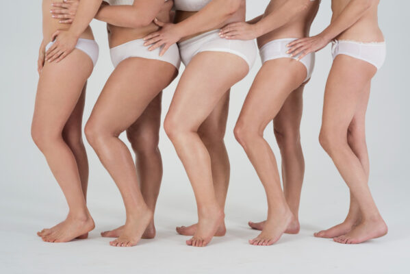 Lipedema