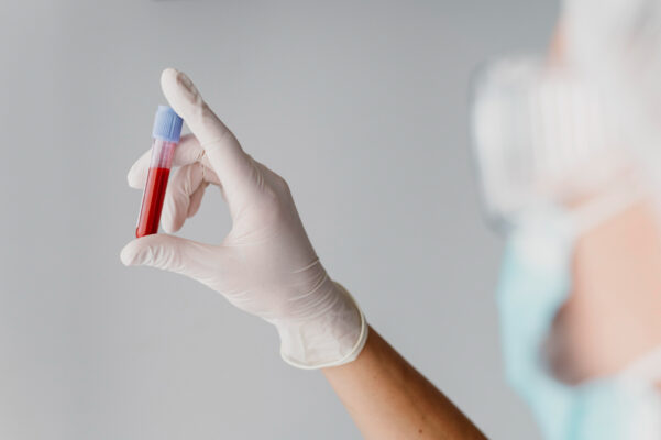 donación de sangre caba